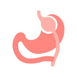 Gastric Bypass