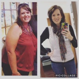 Before and after