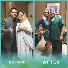 Wendy before and after