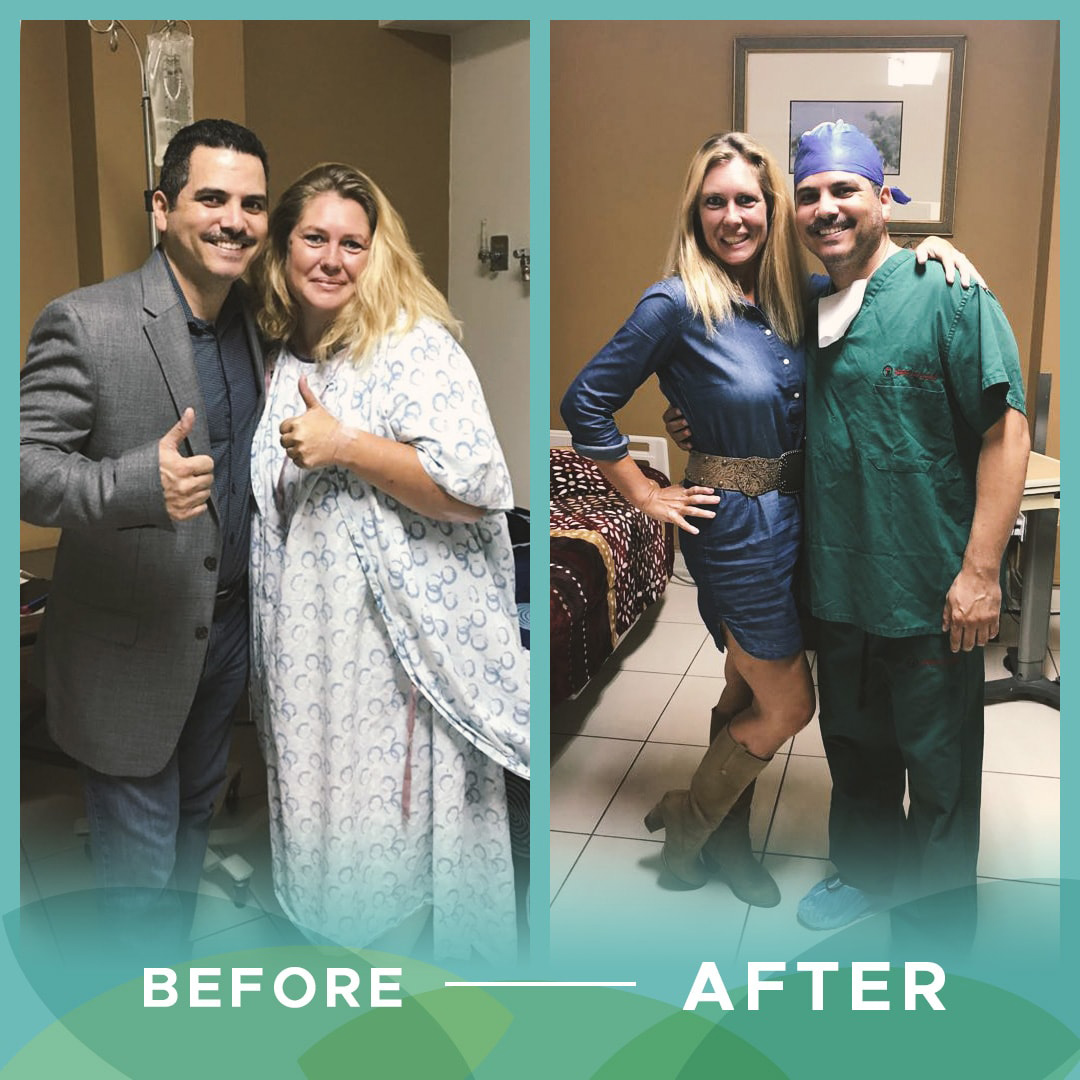 Weight Loss & Plastic Surgery Clinic in Tijuana MX Beauty & Light